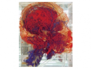 Cast Specimen Series 36