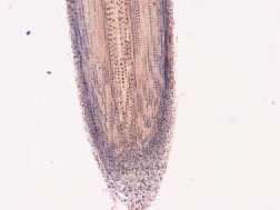 Lily root tip longitudinal section