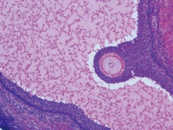 Secondary egg cell section