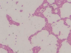 E. coli smear