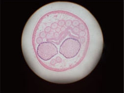 Ascaris female cross section