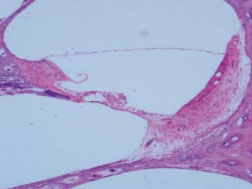 inner ear slice