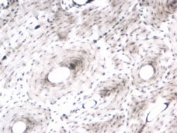Human compact bone