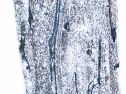Human compact bone