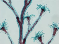 twigs and insects