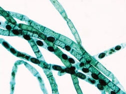 Spirogyra trapezoid slices