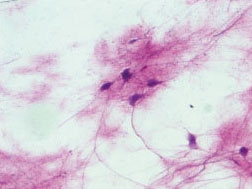 motor neuron mounts