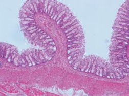 Rectal root slice