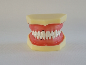 ZM-1_L3 periodontal disease model