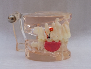 ZM-A16-02_C8 morbid model of premature loss of deciduous teeth