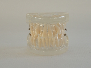 ZM-B11 Orthodontic Training Model