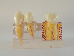 ZM-D2(L11)_M4 Quadruple Tooth Decomposition
