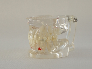 ZM-DSC01796_C5 Mixed dentition model