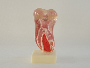ZM-DSC01835__C21 Six times the mandibular molar section