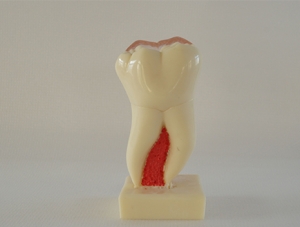 ZM-DSC01836_C21 Six times mandibular molar section