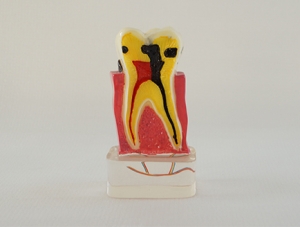 ZM-DSC01843_C17-02 Quadruple periodontal zone nerve
