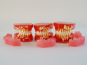 ZM-DSC01935_E1 dentition development model (3-6 years old)