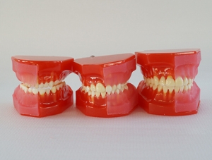 ZM-DSC01936_E1 dentition development model (3-6 years old)