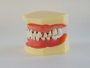 ZM-DSC01951_L4 periodontal disease model