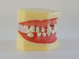 ZM-DSC01952_L4 periodontal disease model