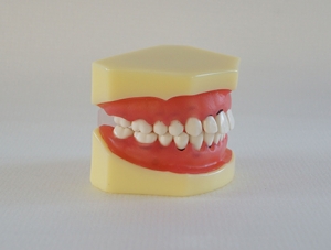 ZM-DSC01956_L3 periodontal disease model