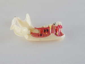 ZM-DSC01970_14 Mandibular tissue decomposition model