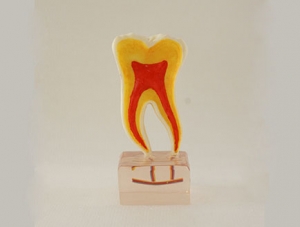 ZM-DSC02171_C20 Six times normal tooth anatomy