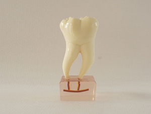 ZM-DSC02172__C20 Six times normal tooth anatomy