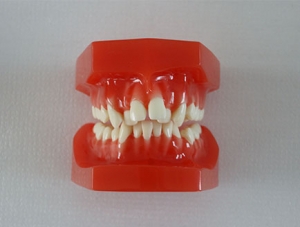 ZM-DSC02282_E8 Orthodontic classification two-color