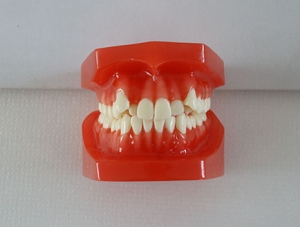 ZM-DSC02289_E8 Orthodontic classification two-color