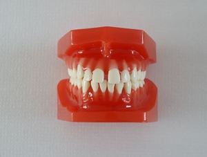 ZM-DSC02290_E8 Orthodontic classification two-color