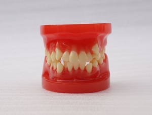 ZM-DSC02400_B4 Orthodontic model