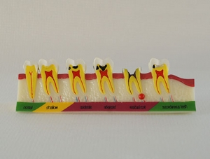 ZM-E8_M7 caries classification model