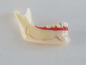 ZM-F6_N14 mandibular tissue decomposition model