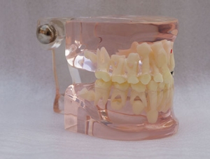 ZM-L13E-02_C7 Seven-year-old deciduous permanent tooth alternation model