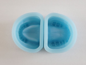 ZM-S5A_G2 Missing tooth negative model