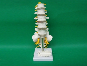 ZM1023-13 5 lumbar vertebrae with sacrum open