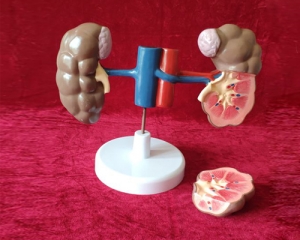 beef kidney